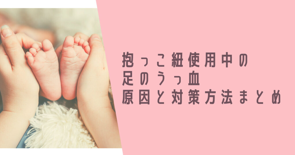 抱っこ紐で赤ちゃんの足がうっ血してしまったときの原因と対策方法は しいの育児ブログ 抱っこ紐で赤ちゃんの足がうっ血してしまったときの原因と対策方法は しいの育児ブログ